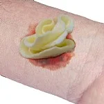 ChitoSAM Hemostatic Dressing 10x10cm - Image 3